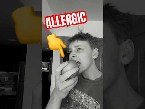 Eating food I’m ALLERGIC to… PART 3
