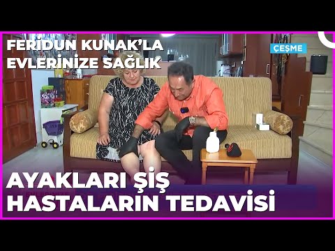 At Kestaneli Kremin Vücuda Faydaları | Dr. Feridun Kunak’la Evlerinize Sağlık