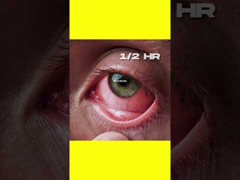 अपनी आँखें झपकाना बंद कर दें तो ? 💀 | What If We Stop Blinking Our Eye | #shorts