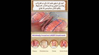 LASER and Laparoscopic surgery.