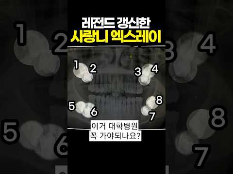 레전드 갱신한 사랑니 엑스레이