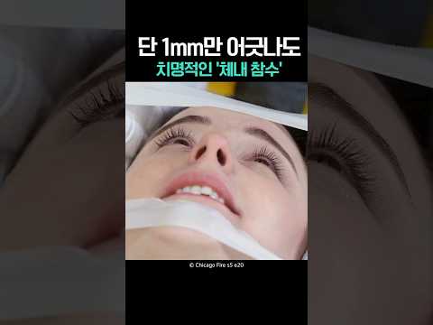 단 1mm만 어긋나도 치명적인 '체내 참수'