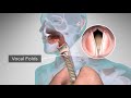 Voice Production and Speech Mechanics