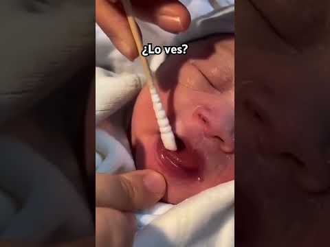 Es muy raro pero algunos bebés nacen con dientes 🦷❤️ ¿Conociste alguno?