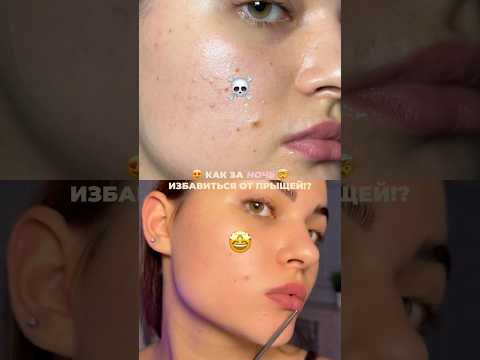 Пилинг против сальных нитей ВБ: #WW110357 от Cosmeya #зумеры #уходзакожей