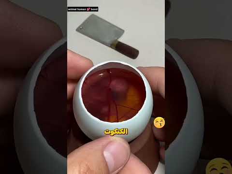 قام بعملية مستحيله لإنقاذ الجنين #shorts