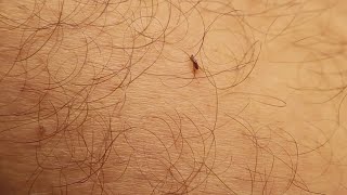 Plague found in South Lake Tahoe resident