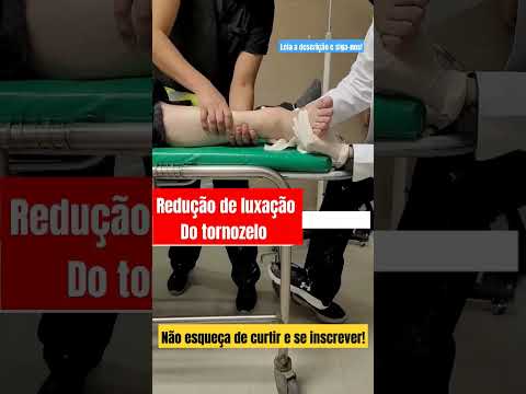 LUXAÇÃO NO TORNOZELO: Sintomas, Causas e Como Tratar Rápido #shortsviral #shorts