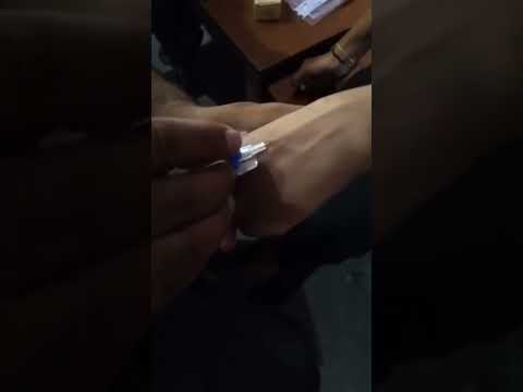 cannulation #mbbs #doctor #viral #motivation #neet