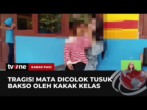 Siswi Di Gresik Buta Akibat Dicolok Tusukan Bakso Oleh Kakak Kelas Tvone