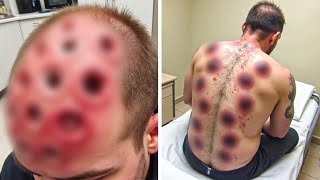 Man Thinks He Has 'Bedbugs' - Experts Look Closer & SCREAM By What They Truly Are!