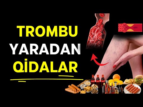 Bu Qidalar Qanınızı Laxtalandırır - Mütləq izləyin !