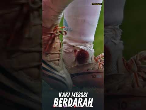 Sampe Berdarah Darah 🥲 Hari Dimana Messi Berjuang Untuk Argentina Sampe Titik Darah Terakhir