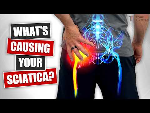 What’s Causing Your Sciatic Nerve Pain? [Tests and Treatment For Sciatica]