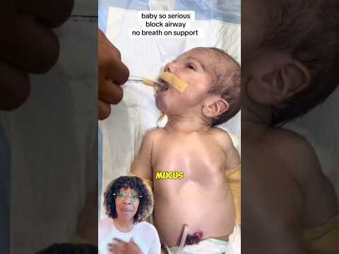 Baby not crying after delivery #shorts ๏ฟผ