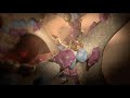 Bone Health and Osteoporosis Concepts