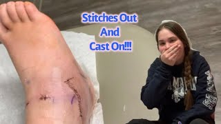 Stitches Out And Cast On Vlog!!!