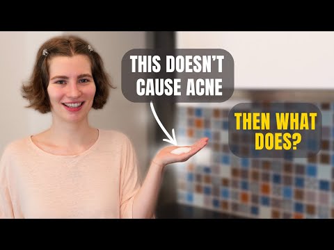 No, Sugar Doesn’t Cause Acne — Here’s What Actually Does