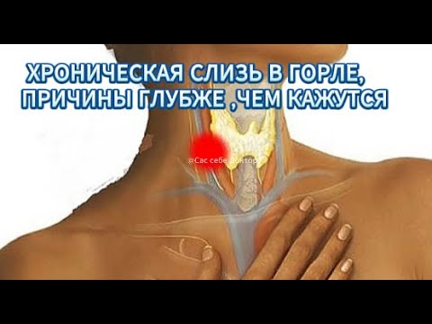 ХРОНИЧЕСКАЯ СЛИЗЬ В ГОРЛЕ,ПРИЧИНЫ ГЛУБЖЕ ,ЧЕМ КАЖЕТСЯ
