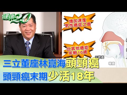 頭頸癌又稱最短命癌症 一旦發現末期少活18年 健康2.0