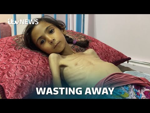 'I want to get treatment and look like I used to': Malnourished Amal, 7, pleads for help in Gaza