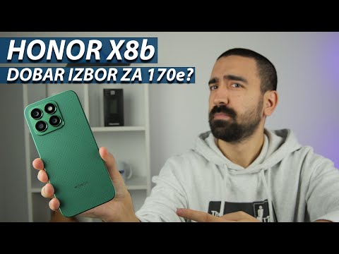 HONOR X8b | ODLIČAN IZBOR ZA 170€?