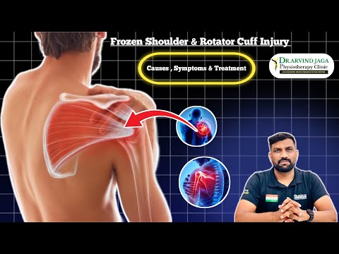 Symptoms of Rotator Cuff Injury and It's Effective Treatments by Dr. Arvind Jaga