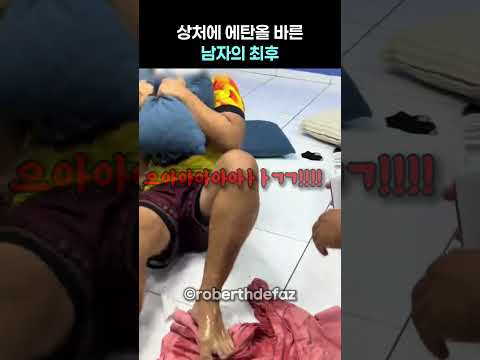 상처에 <strong>에탄올</strong> 바른 남자의 최후