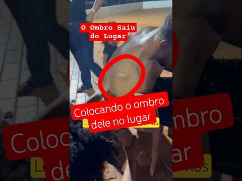 Luxação de Ombro Explicada! | Dor no Ombro, Instabilidade #viralbrasil #shorts