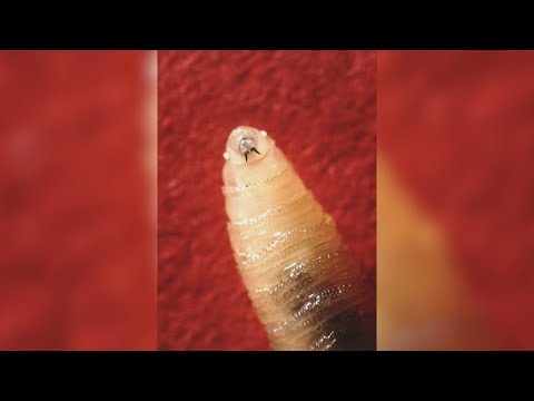 YouTube video thumbnail: Maryland Resident Is Diagnosed With the First U.S. Human Case of Screwworm