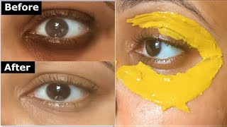 خلال 15 دقيقة فقط تخلصي من الهالات السوداء وانتفاخ و ترهل الجفون وكل التجاعيد حول العين ستختفي
