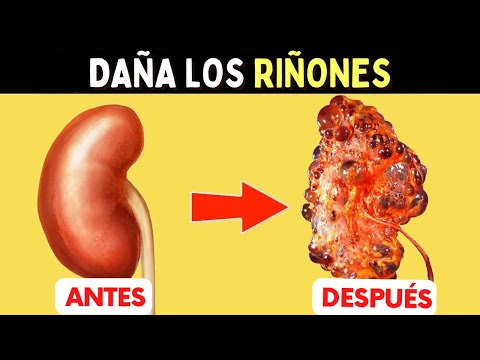 10 Hábitos PELIGROSOS para los RIÑONES - Cuidados IMPORTANTES