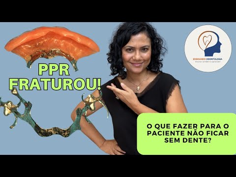 PPR Fraturou e agora?