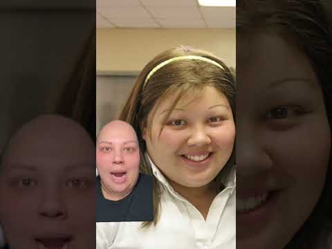 SO SO BAD ? #shortsvideo #youtubeshorts #alopecia #alopeciauniversalis #alopeciaawareness #wig