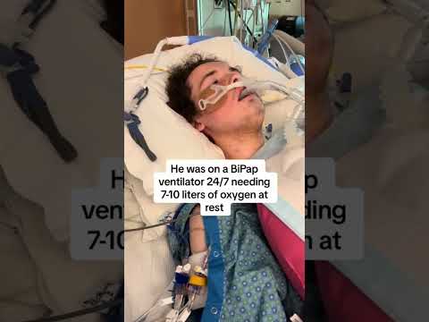 First Breath After Lung Transplant