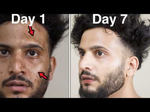 SKIN CARE FOR BOYS IN Hindi[2024]|Get Glowing Skin Naturally At Home|KOREAN SKIN CARE