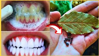The secret dentists don't want you to know: tartar removal and teeth whitening in just two minutes