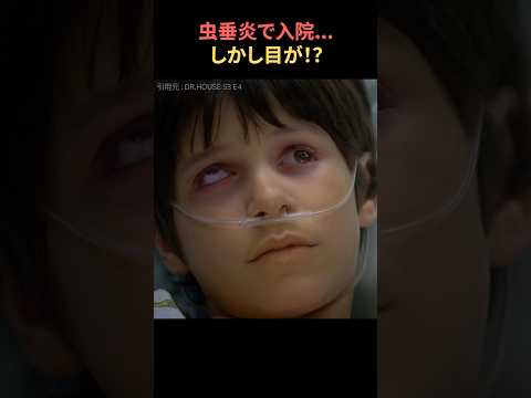 虫垂炎で入院…目がとんでもないことに