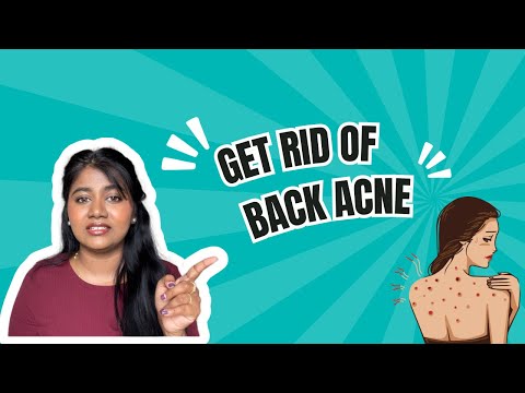 How to Get of Back Acne ! #skincare #backacne #acne #bodyacne #bodywash