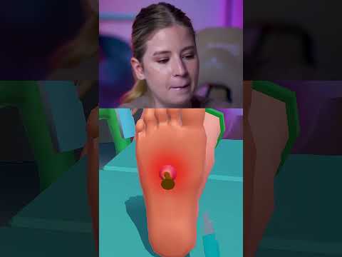 دخل بسمار في رجله