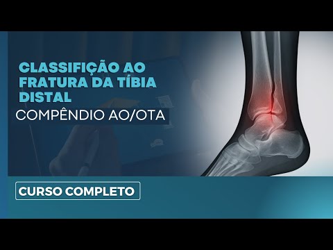 Classificação das Fraturas da Tíbia Distal | Aula Completa  para ortopedistas