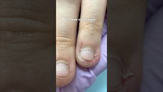 Best shape for bitten nails ? 🤨 #nailcou #nails #nailtransformation
