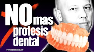 La MEJOR FORMA de REEMPLAZAR TU PRÓTESIS DENTAL sin tener mucho HUESO en las ENCÍAS