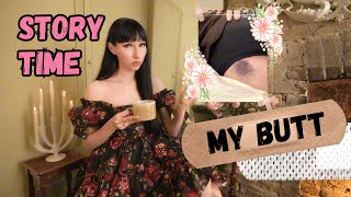 StoryTime: How I injured my BUTTOCKS (three times!)