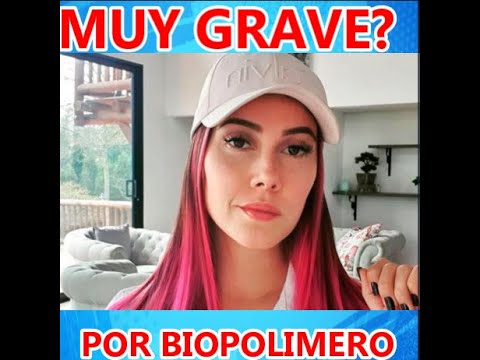 MANUELA GOMEZ ESTA HOSPITALIZADA DE URGENCIAS