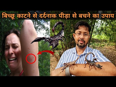 बिच्छू काटने से दर्दनाक पीड़ा से बचने का उपाय