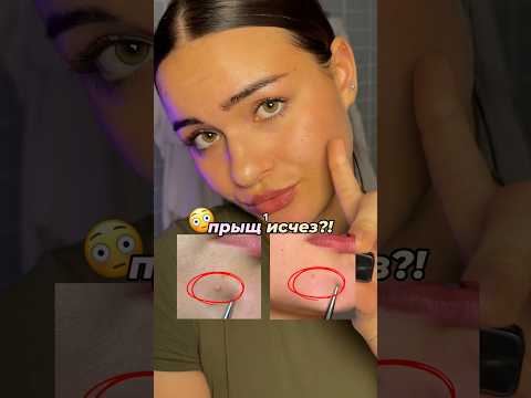 Пилинг против прыщей ВБ: #WW110357 от Cosmeya #зумеры #уходзакожей