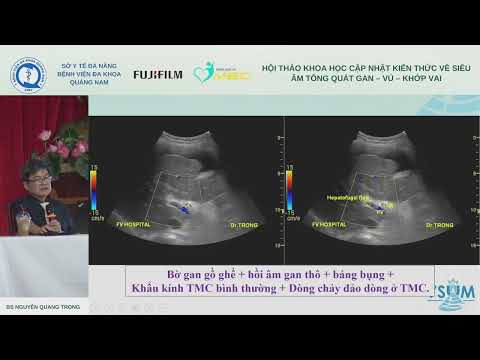 [Short] Siêu âm gan đánh giá tăng áp tĩnh mạch cửa (BS Nguyễn Quang Trọng)