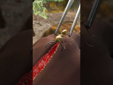 Army Ants Used To Heal Soldier’s Wound🐜