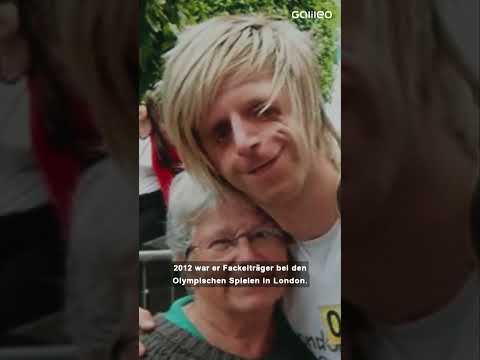 Jono Lancaster lebt mit dem Treacher Collins Syndrom